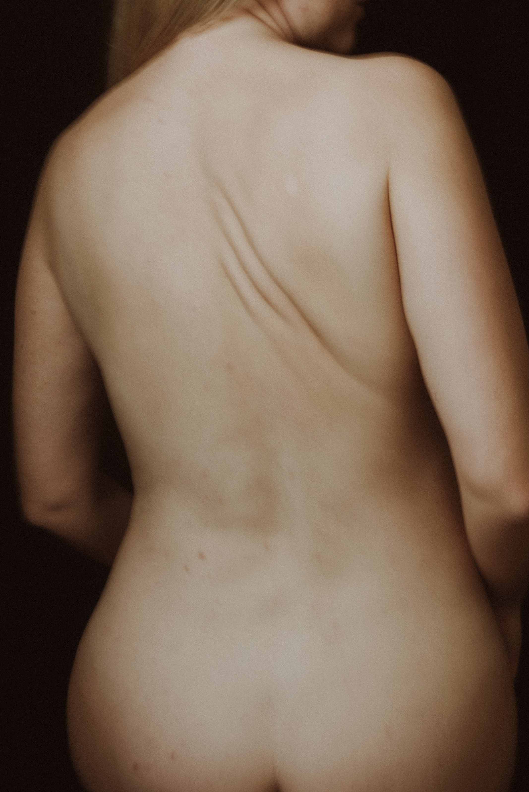 Women's Backs: Strength and Vulnerability